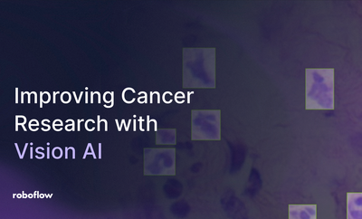 Improving Cancer Research with Roboflow Computer Vision