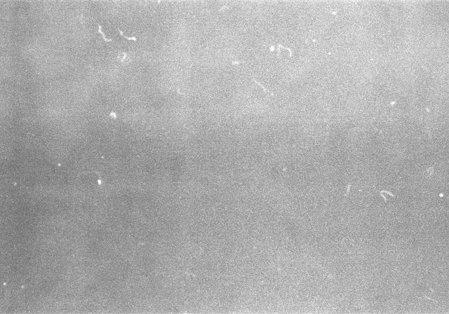 Why to Add Noise to Images for Machine Learning