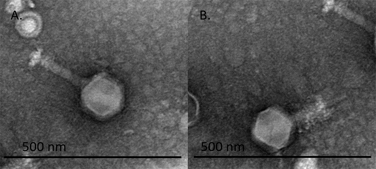 Transmission electron micrograph of fMGyn-Pae01, a phiKZ-like jumbo phage infecting Pseudomonas aeruginosa (Genus Phikzvirus , Chimalliviridae ). A purified phage sample was stained with 2% uranyl acetate and examined with a transmission…