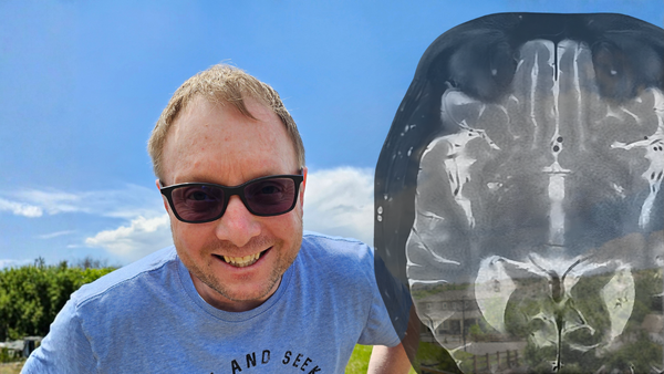MS Dad Origins: How a Routine MRI Changed Everything