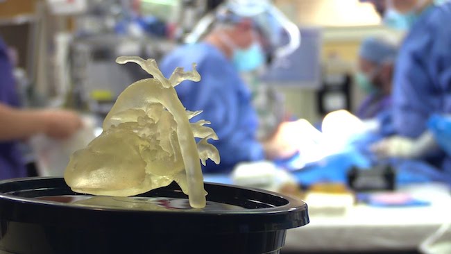3d-printed-organ