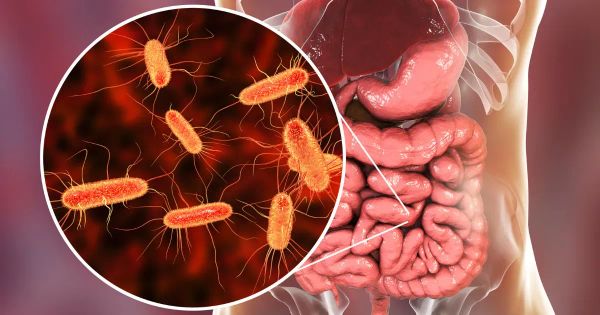 자연적으로 SIBO를 관리하려면 어떻게 해야 하나요?