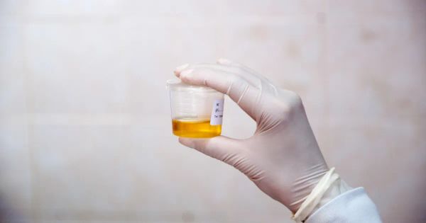 혼탁뇨(탁한 소변)는 무엇을 의미할까요?