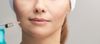dermal filler
