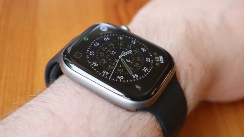Apple Watch Series 11 til rekordlav pris: Skal du købe på Prime Day? Artikelbillede