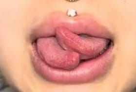 Bifurcated or "split" tongue