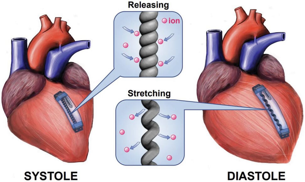 A diagram showing a device attached to a heart, relaxed before the heart expands during a heartbeat, and stretching when it beats