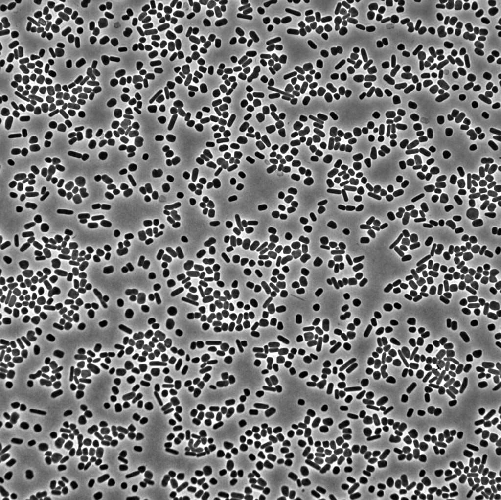 Bacteria growing under a microscope