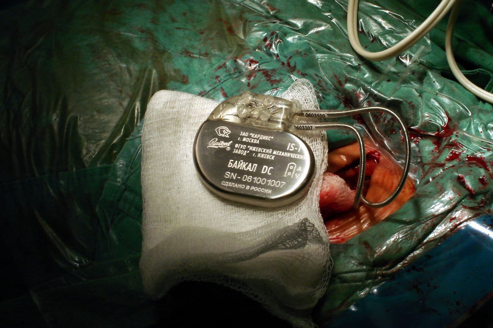 A pacemaker, with a metal wire running out of it, sitting on a surgical bed