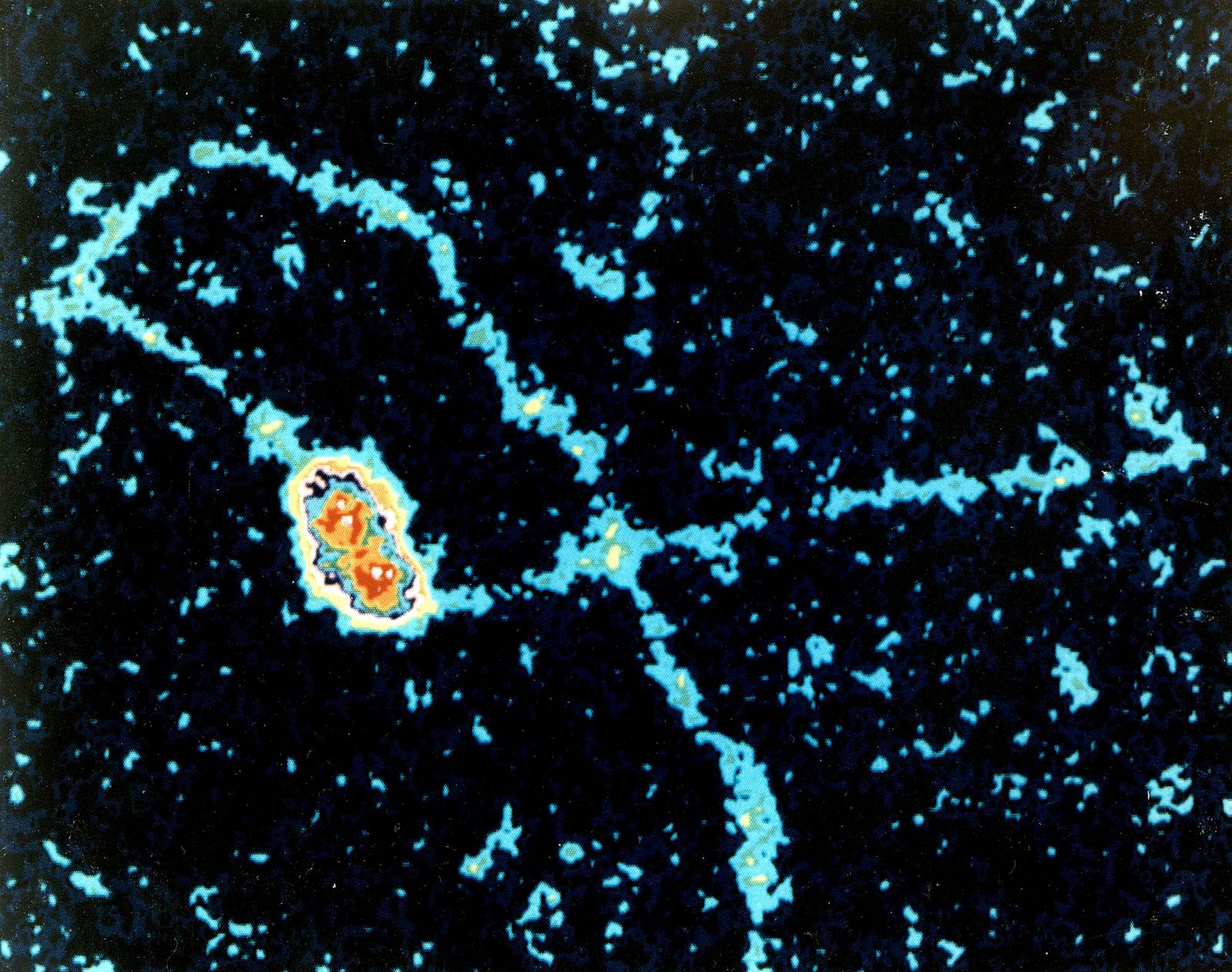 An electron microscope image of DNA replication in a virus, with proteins surrounding DNA being copied.