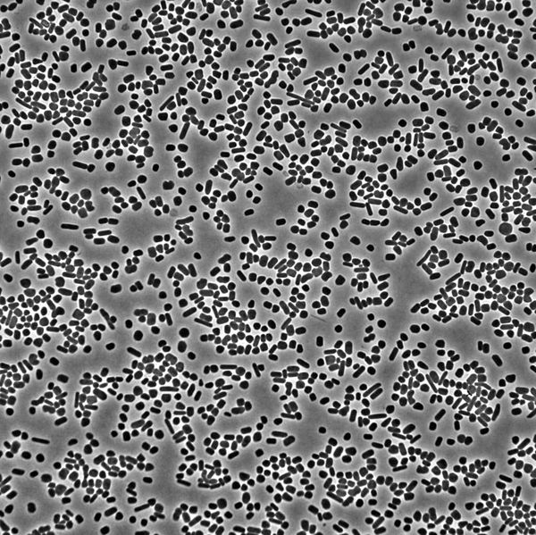 Bacteria growing under a microscope