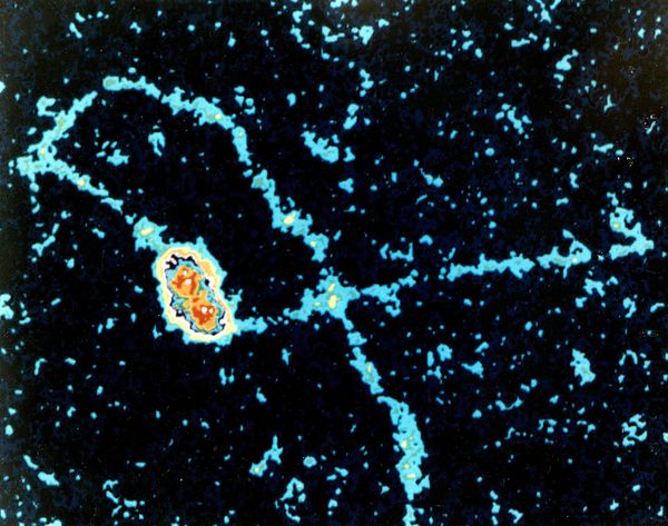 An electron microscope image of DNA replication in a virus, with proteins surrounding DNA being copied.