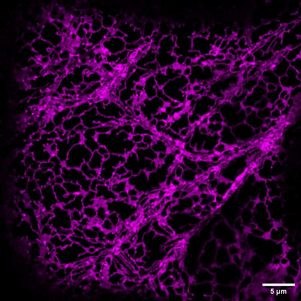 La microscopía de fluorescencia muestra el retículo endoplasmático dentro de las células epidérmicas del tejido foliar de Nicotiana benthamiana. Crédito de la imagen: Olivia Walk.
