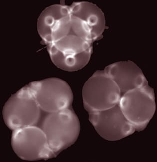 Forme de tétrade et ontogénie du motif d'ouverture dans le pollen