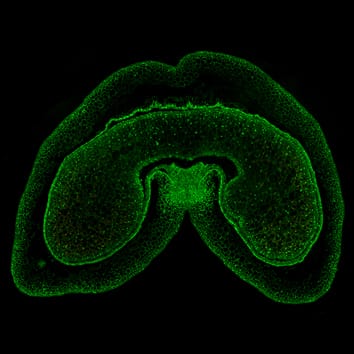 Protein gradients in wheat endosperm