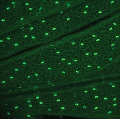 Effet du stress externe sur la densité et la taille des trichomes glandulaires chez l'Artemisia annua adulte, la source d'artémisinine antipaludique