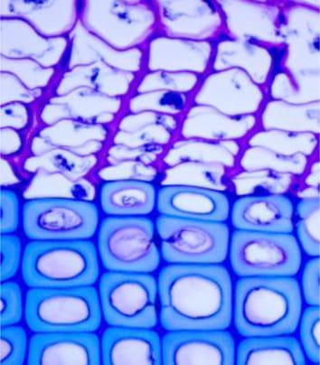 Reconstructing past xylogenesis of black spruce
