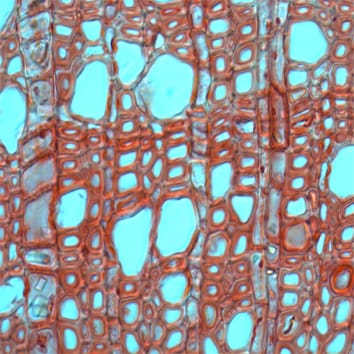 Densité du bois et différenciation fonctionnelle des parenchymes axial et radial