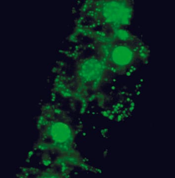 L'imagerie des cellules vivantes révèle une importante colonisation cytoplasmique intracellulaire du bananier par des bactéries endophytes normalement non cultivables