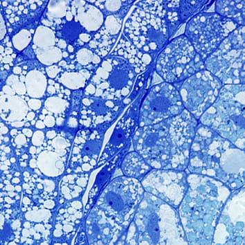 Nueva estructura de la placenta en un licofito