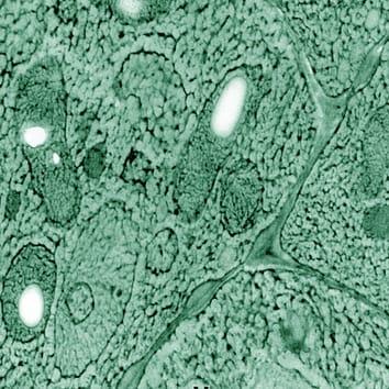 Hielo intracelular y supervivencia celular en semillas de Acer