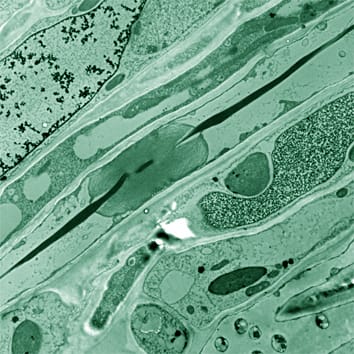 Análisis molecular y evolución de forisomas