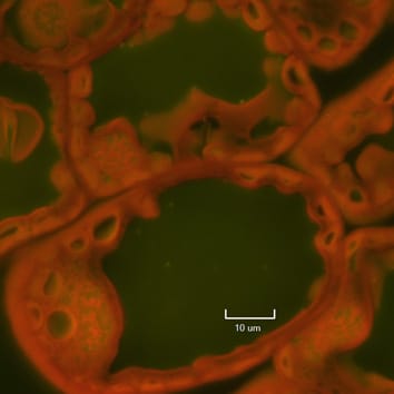 Réponses du feuillage du hêtre et de l'épicéa à l'augmentation du dioxyde de carbone, à l'augmentation des dépôts d'azote et au type de sol