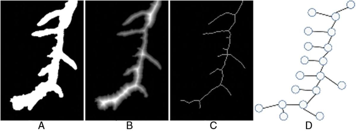 Tout est numéro ? Un moyen plus rapide d'analyser les images de racines de plantes