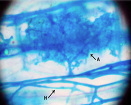 Impacto de un árbol fijador de nitrógeno invasivo en hongos micorrízicos arbusculares y desarrollo de especies nativas