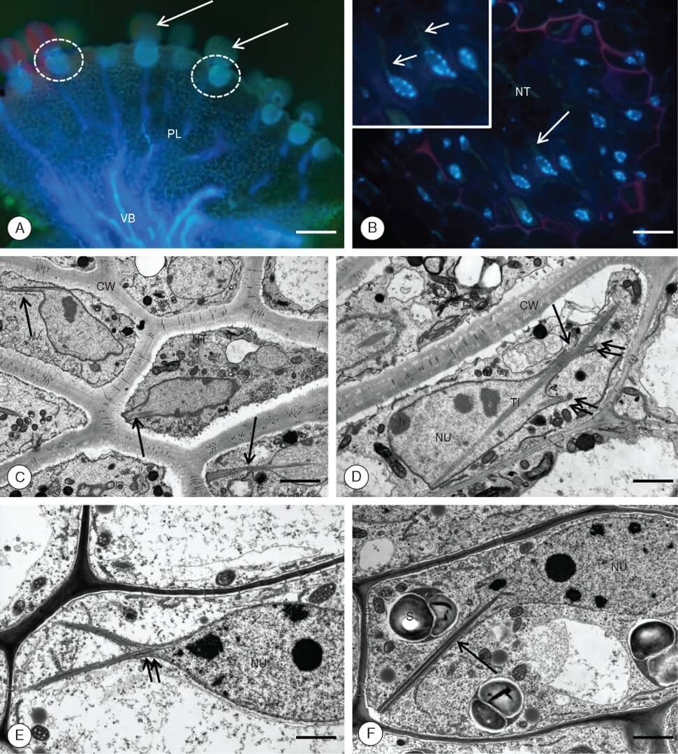 Visualización Serial Block Face-SEM de extensiones tubulares nucleares en una planta carnívora