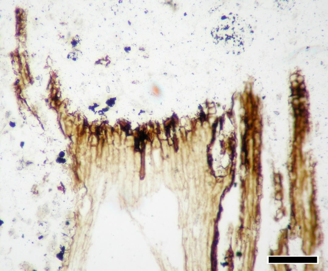 Evidencia microscópica de herbivoría