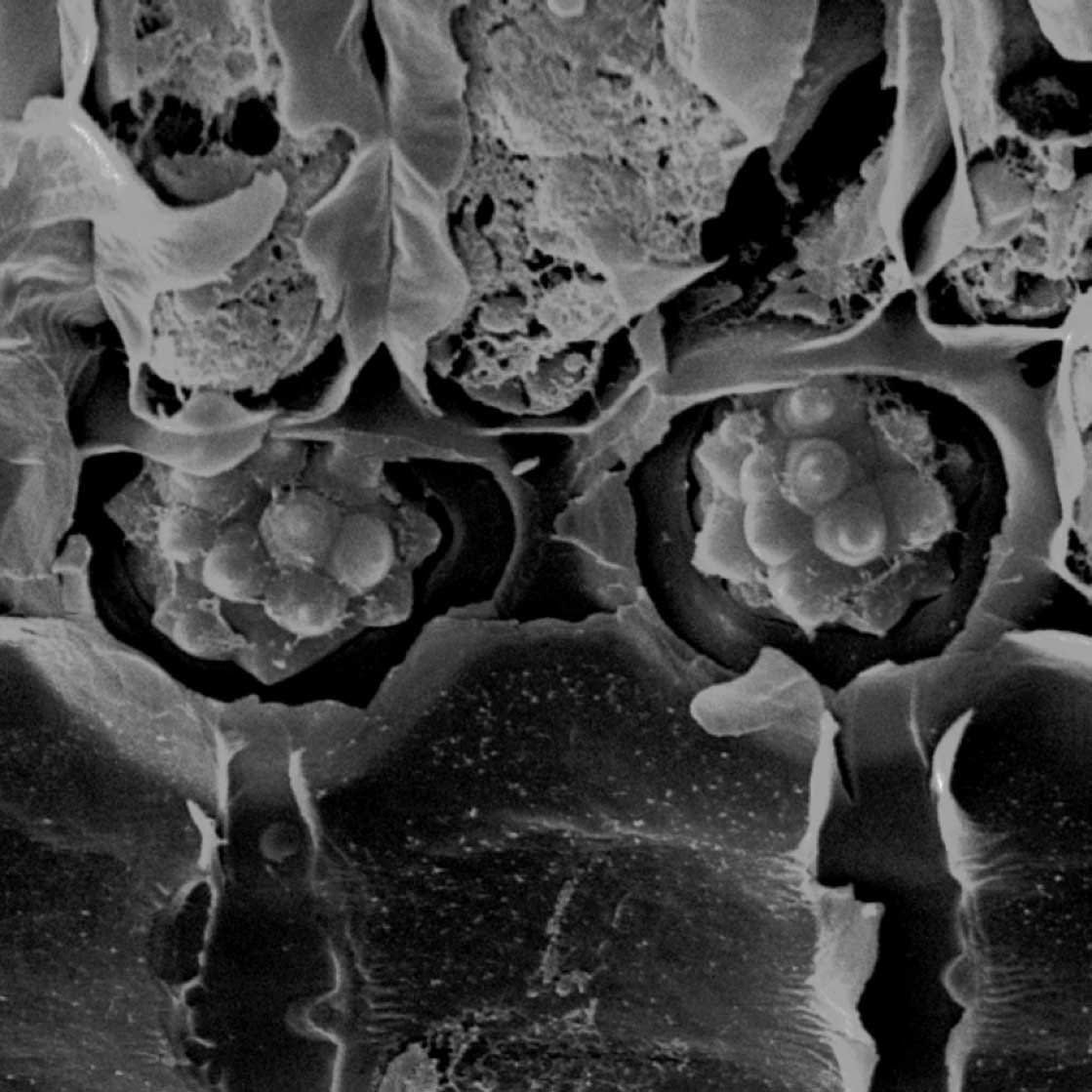 L'anatomie des feuilles facilite-t-elle l'identification des espèces de Butia (Arecaceae)&nbsp;?