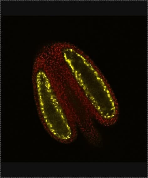 Protéine microspore avortée