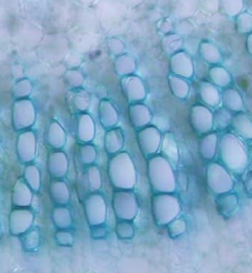 Entwicklung des Xylems der Mittelrippe während der Blattexpansion