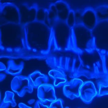 Tapetum et contrôle de la couche intermédiaire de la fertilité mâle chez les kiwis