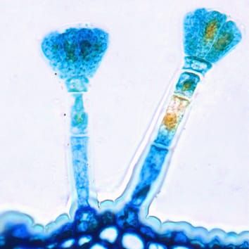 Évolution des trichomes dans les lianes néotropicales