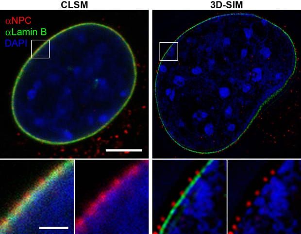 Image: Lothar Schermelleh, Wikimedia Commons (adapted from Schermelleh et al., Science 320: 1332–1336).