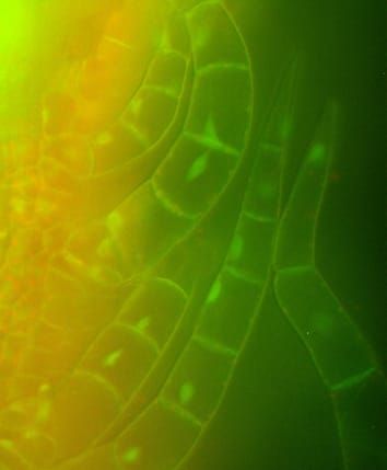 Silencing of tandem transgenes in potato