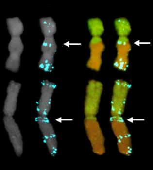 Translocation breakpoints in SSR-rich chromosomal regions