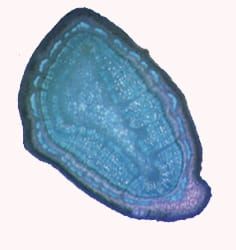 Xylem structure and passive bacterial spread