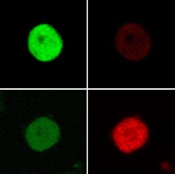 Chloroplast to chromoplast transition in tomato fruit