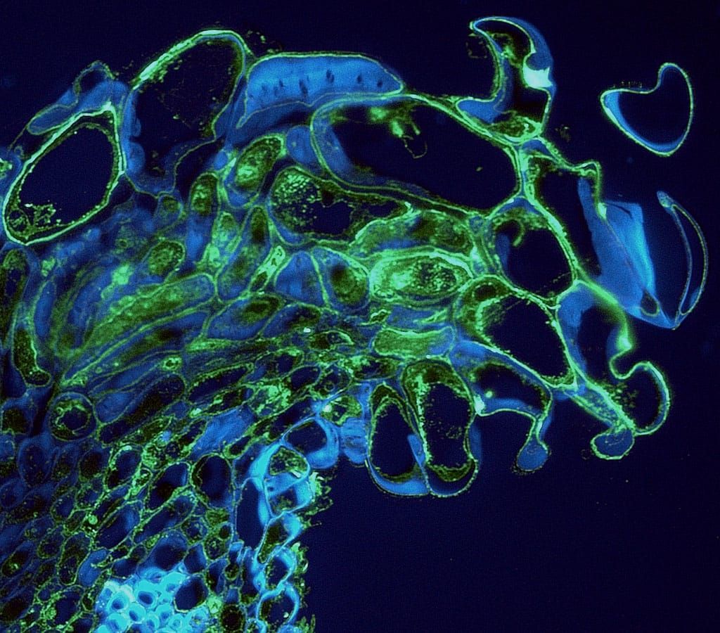 Detail of the stigma of a flower of apple, Malus × domestica