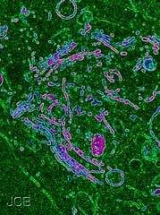 Tales of tethers and tentacles: golgins in plants