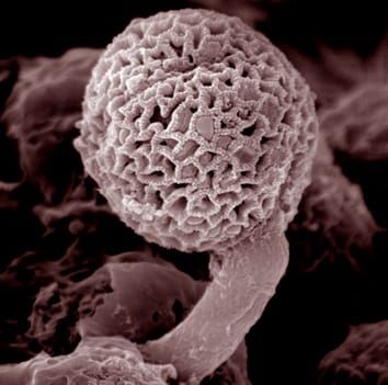 Functional classification of olive pollen esterases