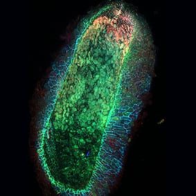 Characterizing sub-optimal clover nodule phenotypes