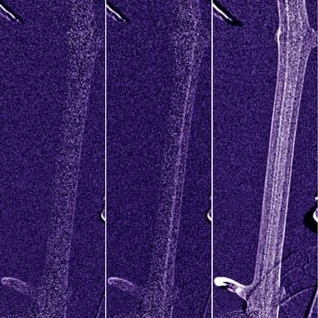 Visualization of embolism formation using cold neutron radiography