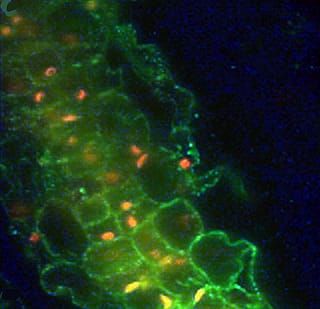 What bacteria are in your banana?