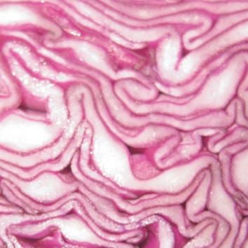 Selenium toxicity in plants (Botanical Briefing)