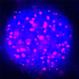 The tannosome: a new chloroplast-derived organelle