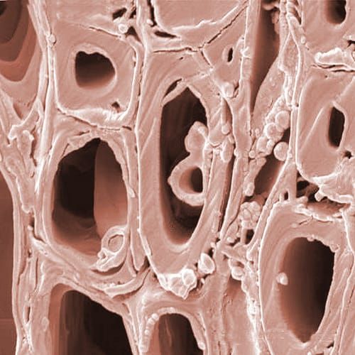 Mechanism of resistance to Dutch elm disease, MADS goes genomic in conifers and floral symmetry and pollination – This Week in Annals of Botany